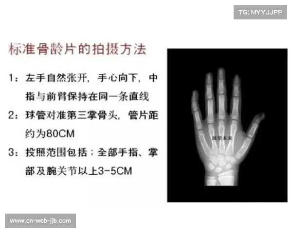 古典跤年龄造假调查揭示省级赛骨龄检测误差超国际标准2.4个百分点